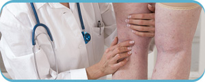 Vein Specialist in Henderson, NV: Safe, Non-Surgical Solutions for Vein Health Vein Specialist in Henderson, NV: Safe, Non-Surgical Solutions for Vein Health